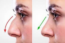 Nose Reshaping Exploring the Art and Science of Rhinoplasty.