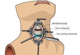 Advancements and Innovations in Head and Neck Surgery.